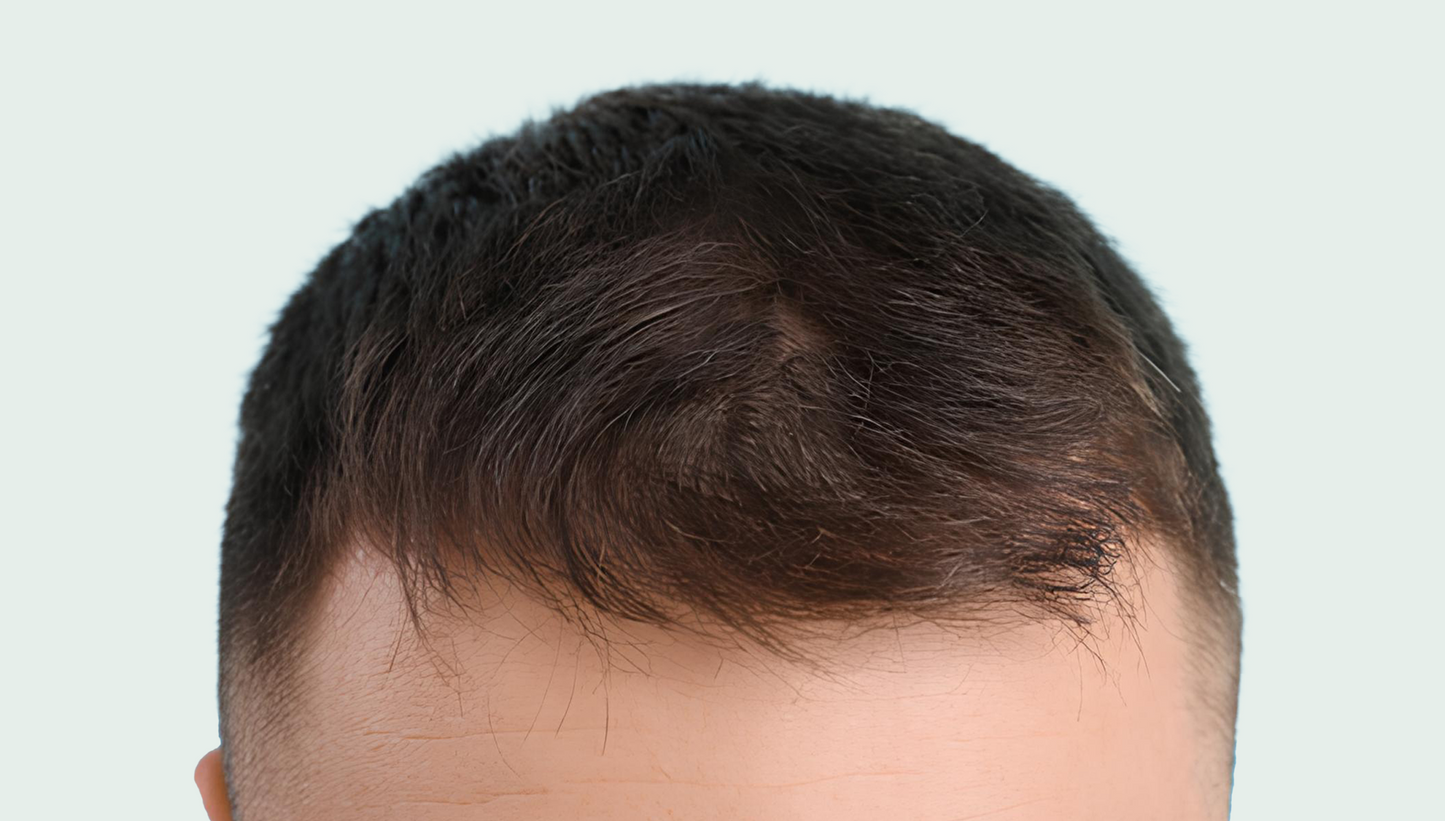 Set of 3 hair care products 15% discount