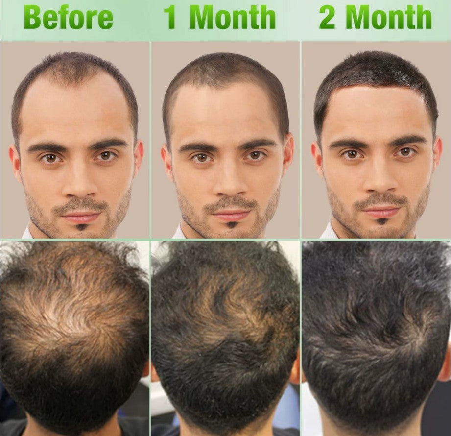 Set of 3 hair care products 15% discount
