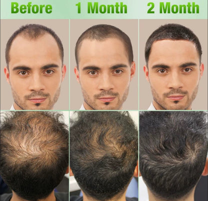 Set of 3 hair care products 15% discount