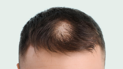 Set of 3 hair care products 15% discount